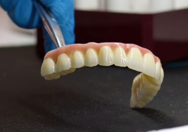 Coronas y Puentes Dentales