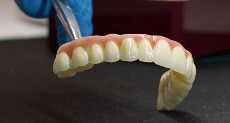 Coronas y Puentes Dentales