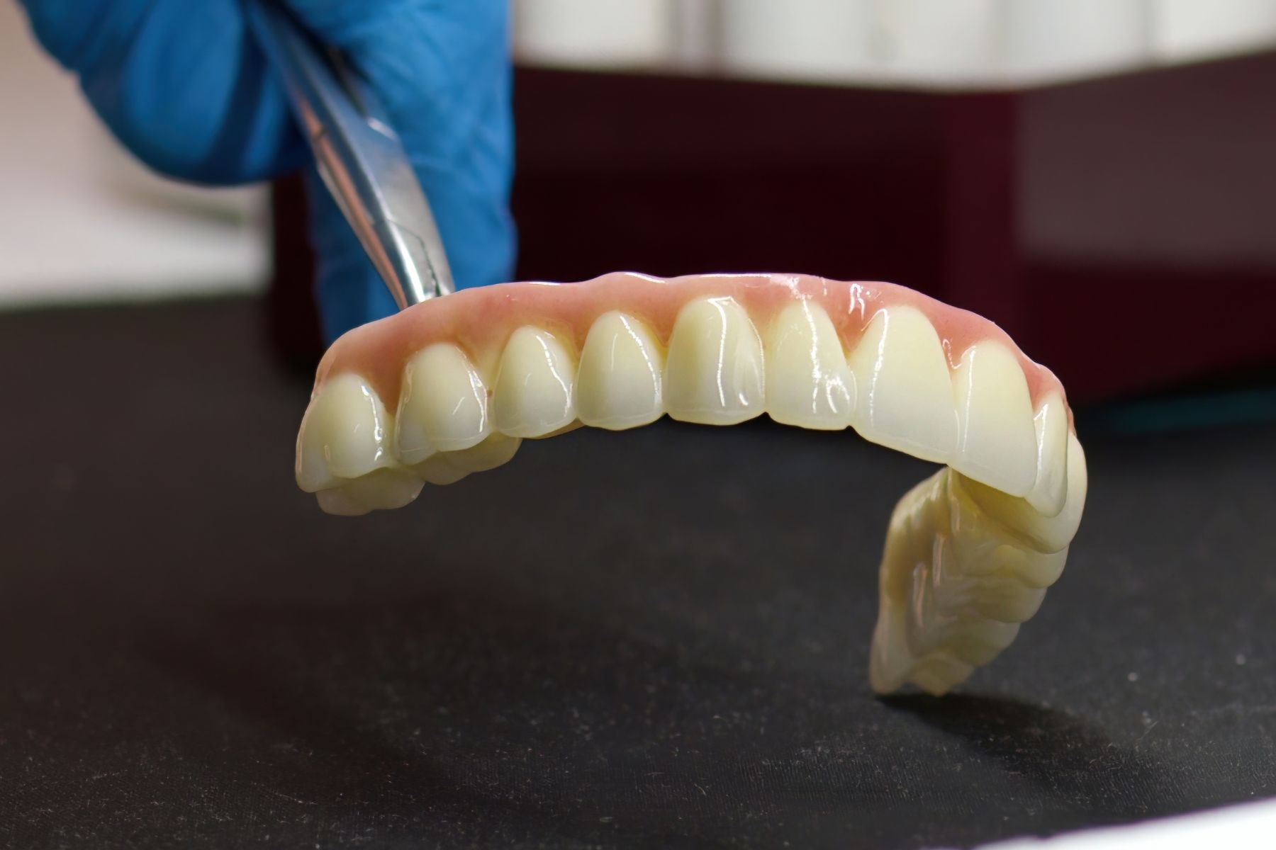 Coronas y Puentes Dentales