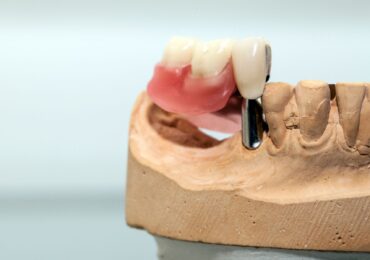 Dientes perdidos